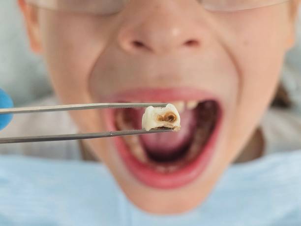Best Emergency Dental Services for Seniors in Chambersburg, PA